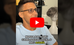 Depoimento de um cliente satisfeito com sua nova prótese capilar da Source Hair
